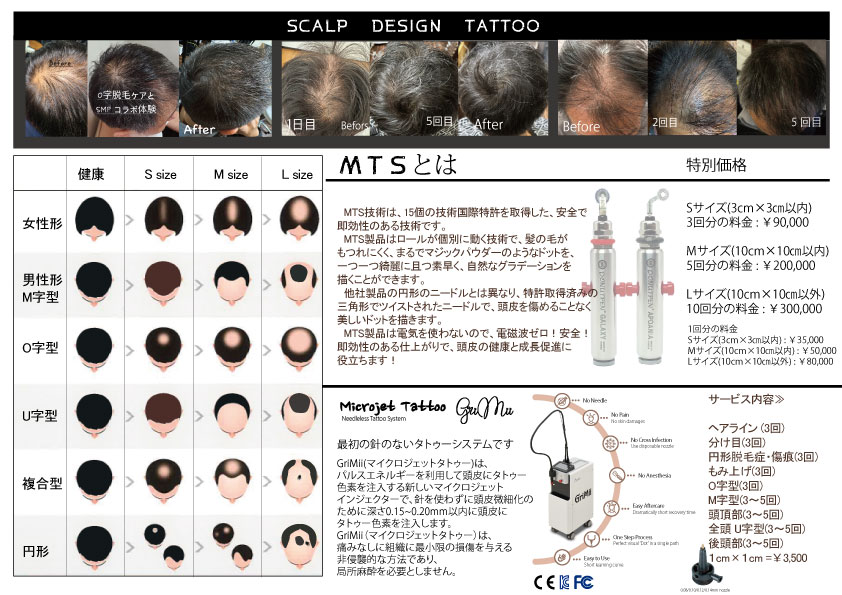 scalp-tattoo-price